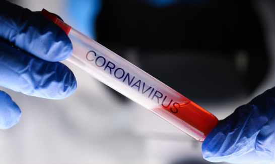 COVID19 – what do you need to know?